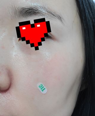 [큐어반H 스팟] 자외선 99프로 차단되는 스틱타입 스팟밴드(1팩 / 66매입) — 5점을 준 리뷰어가 2022년 11월 올린 사용 사진