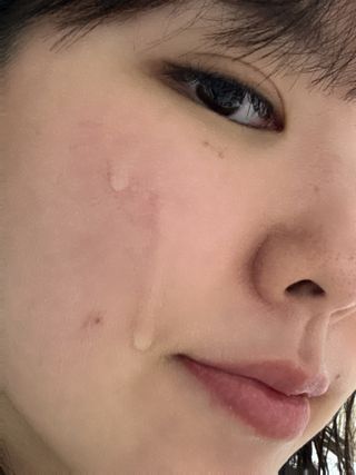 나우 [리브엠] 화해 1등 진정 앰플, 엑소코어 카밍 텐션 앰플 — 4.5점을 준 리뷰어가 2025년 5월 올린 사용 사진