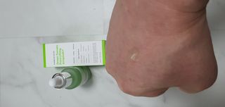 성분에디터 그린토마토 포어 리프팅 앰플 플러스 — 5점을 준 리뷰어가 2021년 7월 올린 사용 사진