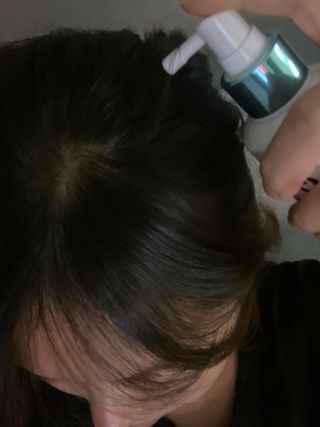 모두발라 탈모집중케어 헤어토닉 — 5점을 준 리뷰어가 2022년 1월 올린 사용 사진