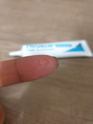 히루스카 포스트아크네 클리어 — 4점을 준 리뷰어가 2021년 1월 올린 사용 사진