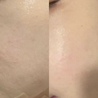 [후르디아] 묻어남NO 비건 메이크업 픽서 — 4점을 준 리뷰어가 2021년 10월 올린 사용 사진