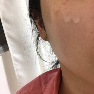 체르엠 스템앤셀 비타민 브라이트닝 에센스 30ml 1개 — 4점을 준 리뷰어가 2021년 6월 올린 사용 사진