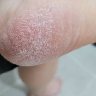 미라클풋 유리발각질제거기 물없이 쓱싹쓱싹 몇번만에 발각질 완벽제거 — 5점을 준 리뷰어가 2021년 9월 올린 사용 사진