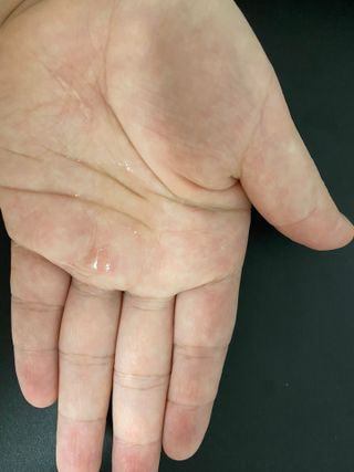 바이오오일 [바이오-오일] 스킨케어 오일 내추럴 60ml — 5점을 준 리뷰어가 2021년 7월 올린 사용 사진
