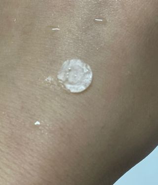 소담스퀘어 상암 디팩코퍼레이션 놀라아워 비건 하이드로콜로이드 클리어 패치 — 3점을 준 리뷰어가 2023년 1월 올린 사용 사진
