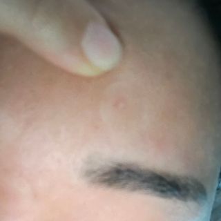 [큐어반H 스팟] 자외선 99프로 차단되는 스틱타입 스팟밴드(1팩 / 66매입) — 5점을 준 리뷰어가 2022년 11월 올린 사용 사진