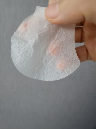 리더스코스메틱 리더스 카밍 바이오틱스 퀵 수딩 패드 — 4.5점을 준 리뷰어가 2022년 7월 올린 사용 사진