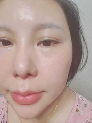 아이엠셀 하이드로 B5 리제너레이션 크림 — 5점을 준 리뷰어가 2021년 5월 올린 사용 사진
