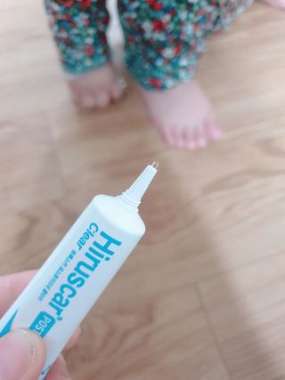 히루스카 포스트아크네 클리어 — 5점을 준 리뷰어가 2021년 1월 올린 사용 사진