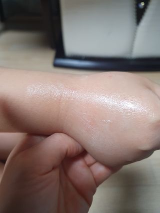 건선/아토/습진/민감성 피부 천연보습진정크림 소리온 크림 & 센시티브 크림 50g — 4.5점을 준 리뷰어가 2022년 1월 올린 사용 사진