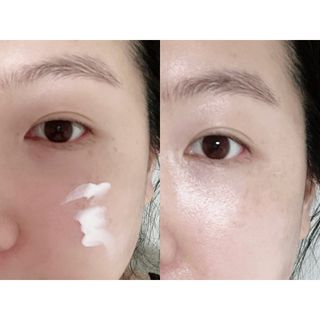 젠바이오 코스메틱스 젠바이오수딩크림]   가려운 피부 & 아토피 원픽 크림 — 5점을 준 리뷰어가 2022년 7월 올린 사용 사진