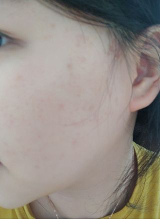 김정문알로에 큐어 큐어 맥시 알로에베라 겔 크림 — 4.5점을 준 리뷰어가 2021년 3월 올린 사용 사진