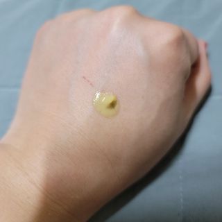 건선/아토/습진/민감성 피부 천연보습진정크림 소리온 크림 & 센시티브 크림 50g — 5점을 준 리뷰어가 2022년 1월 올린 사용 사진