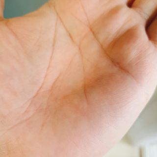썸헤어 / SUMHAIR 썸헤어 써밋 안티 헤어로스 토닉 — 5점을 준 리뷰어가 2021년 6월 올린 사용 사진