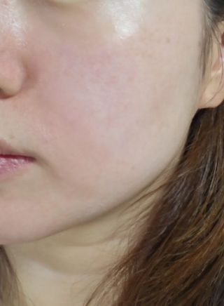 프리 (블로그체험단) [밀리밀리] 메디 앰플 비타 15ml — 5점을 준 리뷰어가 2025년 7월 올린 사용 사진
