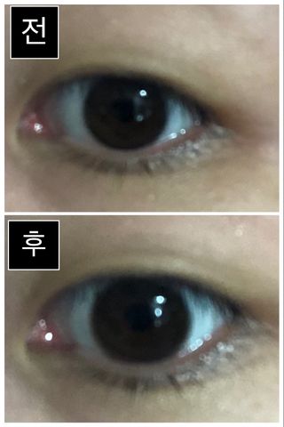 [렌즈타운] 누디코코 — 4점을 준 리뷰어가 2021년 9월 올린 사용 사진