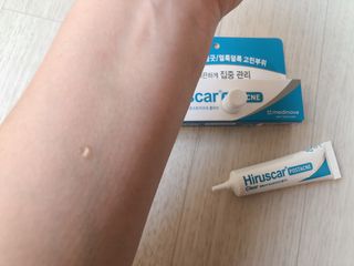 히루스카 포스트아크네 클리어 — 4.5점을 준 리뷰어가 2021년 1월 올린 사용 사진