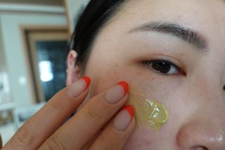 건선/아토/습진/민감성 피부 천연보습진정크림 소리온 크림 & 센시티브 크림 50g — 5점을 준 리뷰어가 2022년 1월 올린 사용 사진