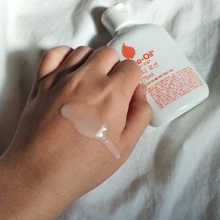 바이오오일 [바이오-오일] 바디 로션 175ml — 5점을 준 리뷰어가 2021년 11월 올린 사용 사진