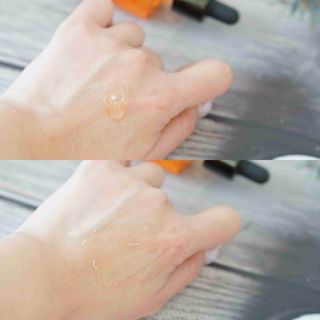 바이리뮤 에이지 홀딩 펩타톡스 앰플 — 5점을 준 리뷰어가 2021년 1월 올린 사용 사진