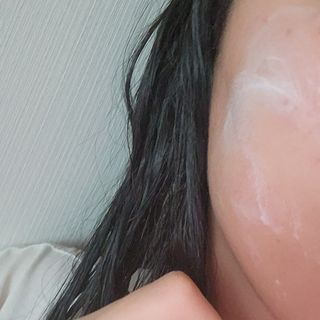 젠바이오 코스메틱스 젠바이오수딩크림]   가려운 피부 & 아토피 원픽 크림 — 4점을 준 리뷰어가 2022년 9월 올린 사용 사진