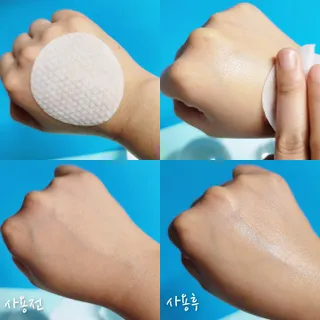 키노닉스 양배추 카밍 진정 토너패드 — 5점을 준 리뷰어가 2021년 7월 올린 사용 사진