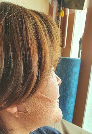 아이디플라코스메틱 아이디 페이스핏 마이너스 밴드 v2 — 4점을 준 리뷰어가 2021년 10월 올린 사용 사진