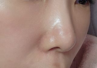 [큐어반H 스팟] 자외선 99프로 차단되는 스틱타입 스팟밴드(1팩 / 66매입) — 5점을 준 리뷰어가 2022년 11월 올린 사용 사진