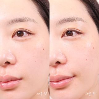 [보히케어] 컨센트레이트 이데베논 7 펩타이드 콤플렉스 앰플 — 5점을 준 리뷰어가 2023년 8월 올린 사용 사진
