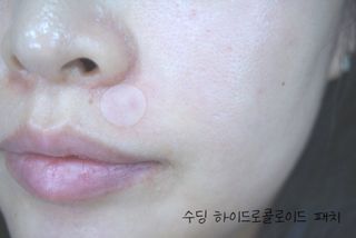 세뚜아(Cettua) 세뚜아 스팟 클리어 듀얼 패치 Cettua Spot Clear Dual Patch — 5점을 준 리뷰어가 2023년 10월 올린 사용 사진