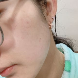 플리프 시카 알로에 스팟키트 — 4점을 준 리뷰어가 2021년 2월 올린 사용 사진