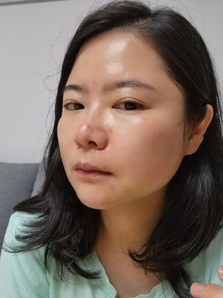 씽크바이오 히알루론 에센스 에어볼 28ea — 4.5점을 준 리뷰어가 2022년 9월 올린 사용 사진