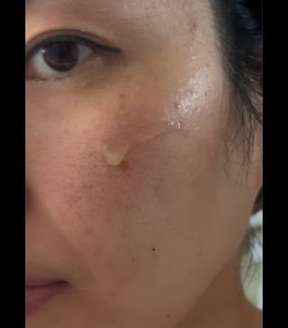 *✅프리 (블로그체험단) [밀리밀리] 메디 앰플 시카 15ml — 5점을 준 리뷰어가 2025년 9월 올린 사용 사진