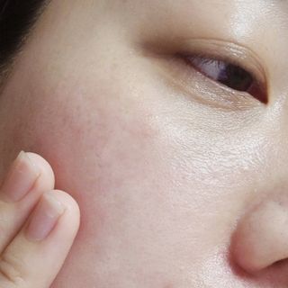 브에노 스킨셀 더마 앰플 — 4점을 준 리뷰어가 2021년 6월 올린 사용 사진