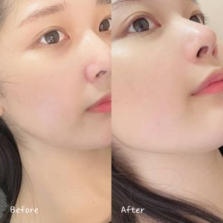 [아벨루나] 모공고민 싹 빨아들이는 홈 뷰티 디바이스 아쿠아필링기 아벨루나 M-200 — 5점을 준 리뷰어가 2021년 6월 올린 사용 사진