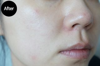 체르엠  프루브 콜라겐 앰플세럼 60ml 1병 — 5점을 준 리뷰어가 2021년 9월 올린 사용 사진