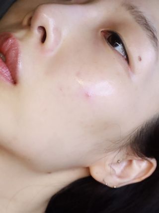 네오메딕스 뷰티 [네오메딕스] 바노바기 피포뮬러 — 4.5점을 준 리뷰어가 2024년 8월 올린 사용 사진