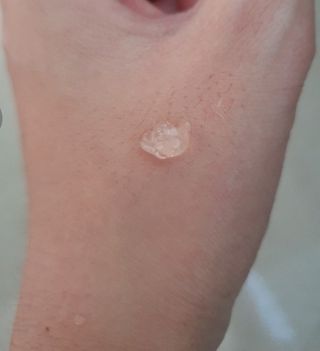 레드투래드 센서티브 어메이징 앰플 30ml — 5점을 준 리뷰어가 2021년 11월 올린 사용 사진