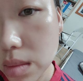 위뜨 펩타이드 컨센트레이트 크림 — 5점을 준 리뷰어가 2022년 6월 올린 사용 사진