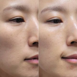 아이디플라코스메틱 페이스핏 플라스터 마스크 _ 리뉴얼 — 5점을 준 리뷰어가 2021년 7월 올린 사용 사진