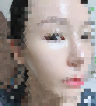 유니베르소 산소앰플 7일 집중케어 앰플 — 5점을 준 리뷰어가 2021년 8월 올린 사용 사진
