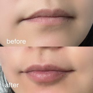 틱톡 [후르디아] 튼입술해결템 올리브영 블루베리 하이드레이팅 허니 립밤 — 5점을 준 리뷰어가 2023년 12월 올린 사용 사진