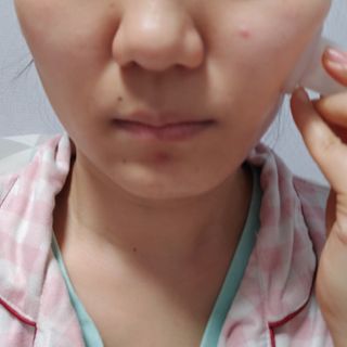 메디미케이알 커핑테라피 실리콘부항마사지 리프팅 페이스+바디 안티 셀룰 라이트 6pcs — 5점을 준 리뷰어가 2021년 2월 올린 사용 사진