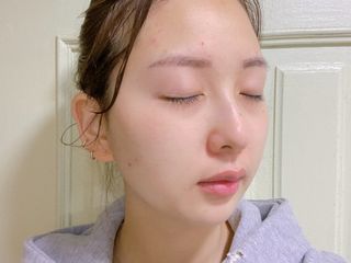 마이디플러스 아토비옴 4종 기프트 패키지 — 5점을 준 리뷰어가 2021년 11월 올린 사용 사진