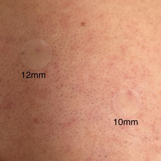 [큐어반H 스팟] 자외선 99프로 차단되는 스틱타입 스팟밴드(1팩 / 66매입) — 5점을 준 리뷰어가 2022년 11월 올린 사용 사진