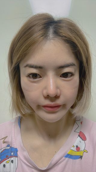 닥터플리너스 필인셀 멀티 패치 28days — 5점을 준 리뷰어가 2022년 4월 올린 사용 사진