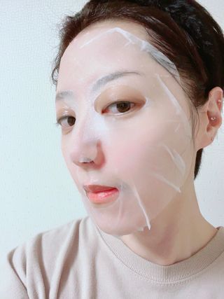 비프리코스메틱 더블아이스진정마스크팩 5매 — 5점을 준 리뷰어가 2023년 2월 올린 사용 사진