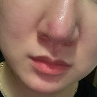 나우 [리브엠] 화해 1등 각질 클렌저! 시카좀 카밍 딥 클렌징 폼 — 4.5점을 준 리뷰어가 2025년 6월 올린 사용 사진