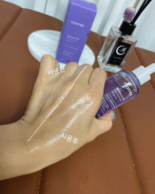 루트리 오디베리 5중 모공 리파이닝 앰플 — 5점을 준 리뷰어가 2023년 8월 올린 사용 사진